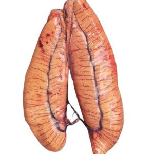 ইলিশের ডিম (Hilsa Roe)